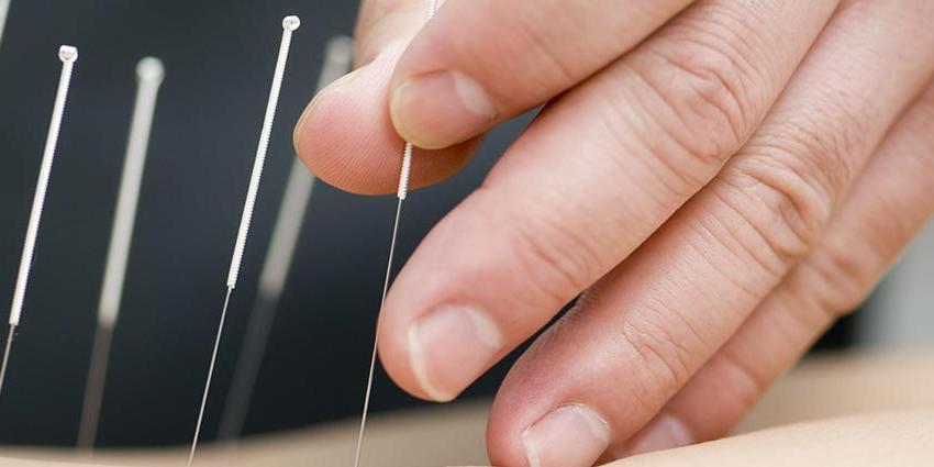 students practicing in the UB Acupuncture Institute in CT